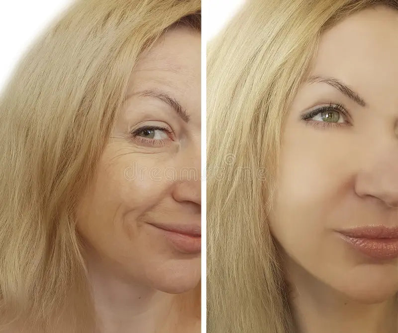 RETINOL SHOT SERUM TRATAMIENTO ANTIARRUGAS