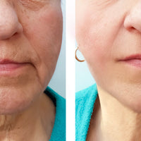 RETINOL SHOT SERUM TRATAMIENTO ANTIARRUGAS