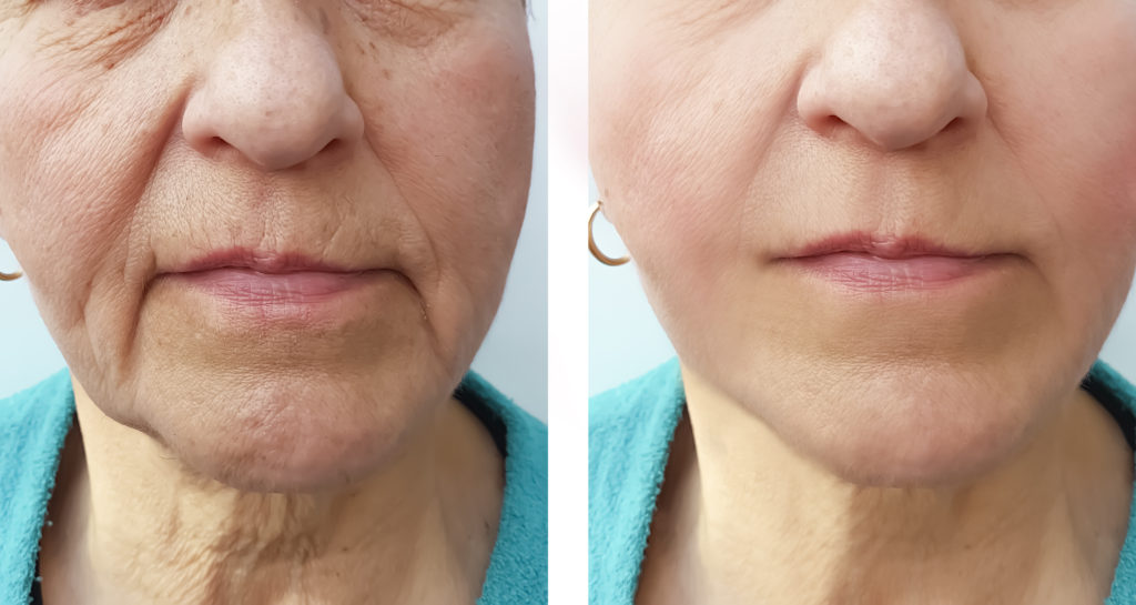 RETINOL SHOT SERUM TRATAMIENTO ANTIARRUGAS