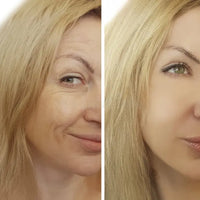 RETINOL SHOT SERUM TRATAMIENTO ANTIARRUGAS