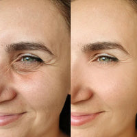 RETINOL SHOT SERUM TRATAMIENTO ANTIARRUGAS