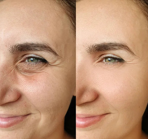 RETINOL SHOT SERUM TRATAMIENTO ANTIARRUGAS